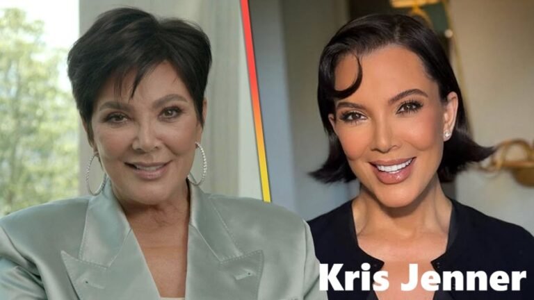 Kris Jenner Face Lift